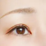 【目の下のクマに悩む方へ】原因や治療方法について徹底解説!